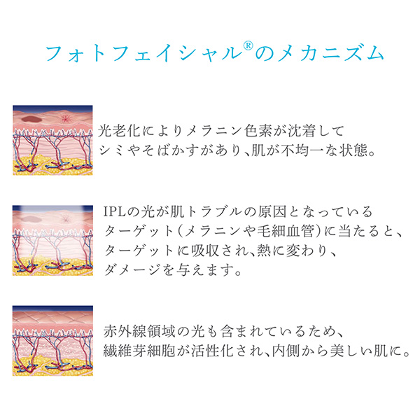 フォトフェイシャルのメカニズム
