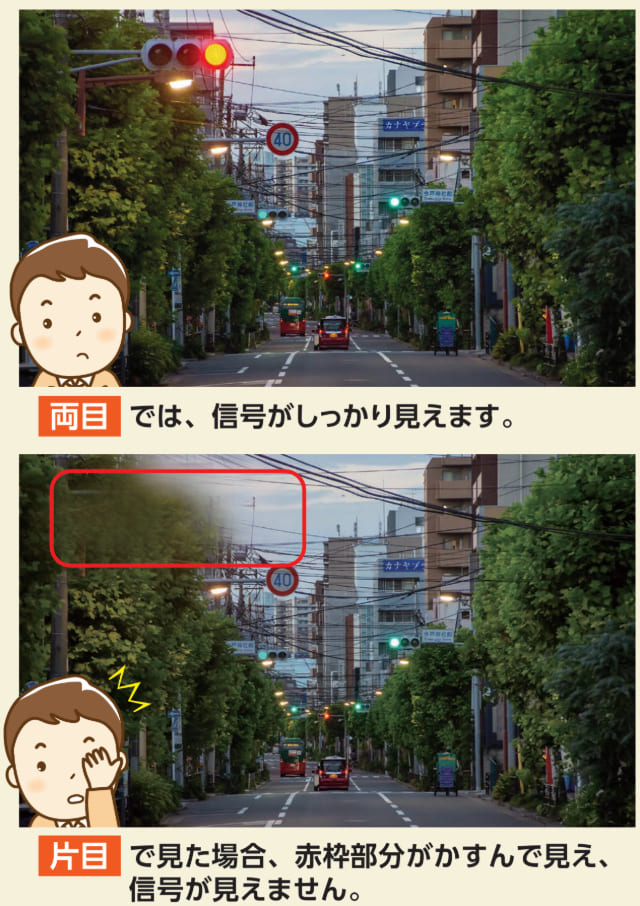 緑内障の見え方