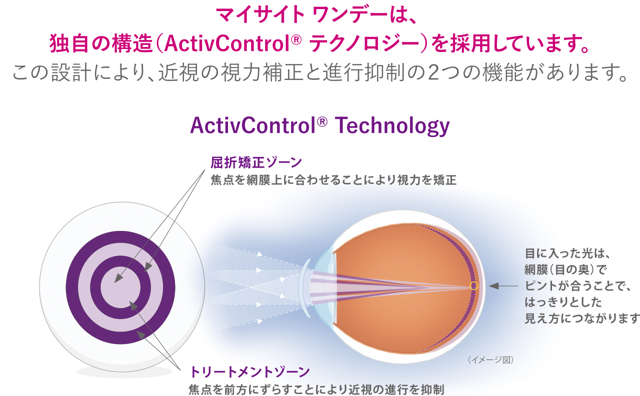 マイサイト®1day