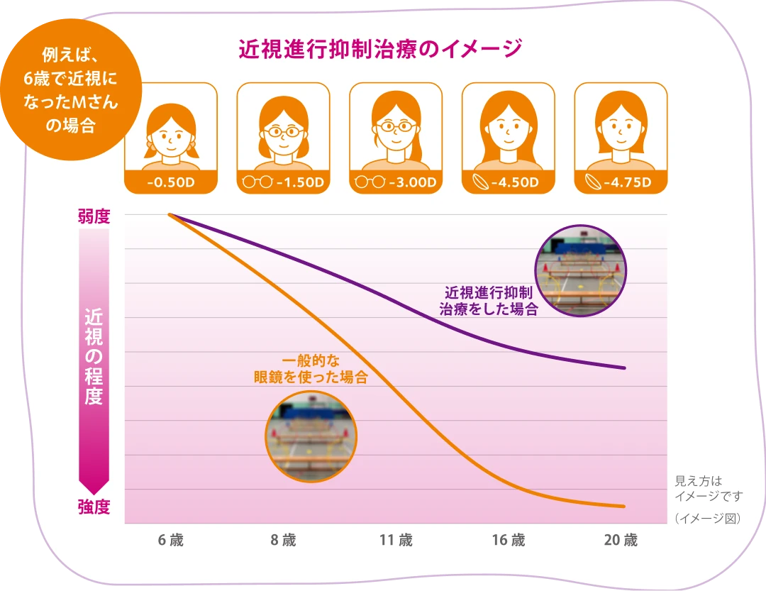 マイサイト®1day